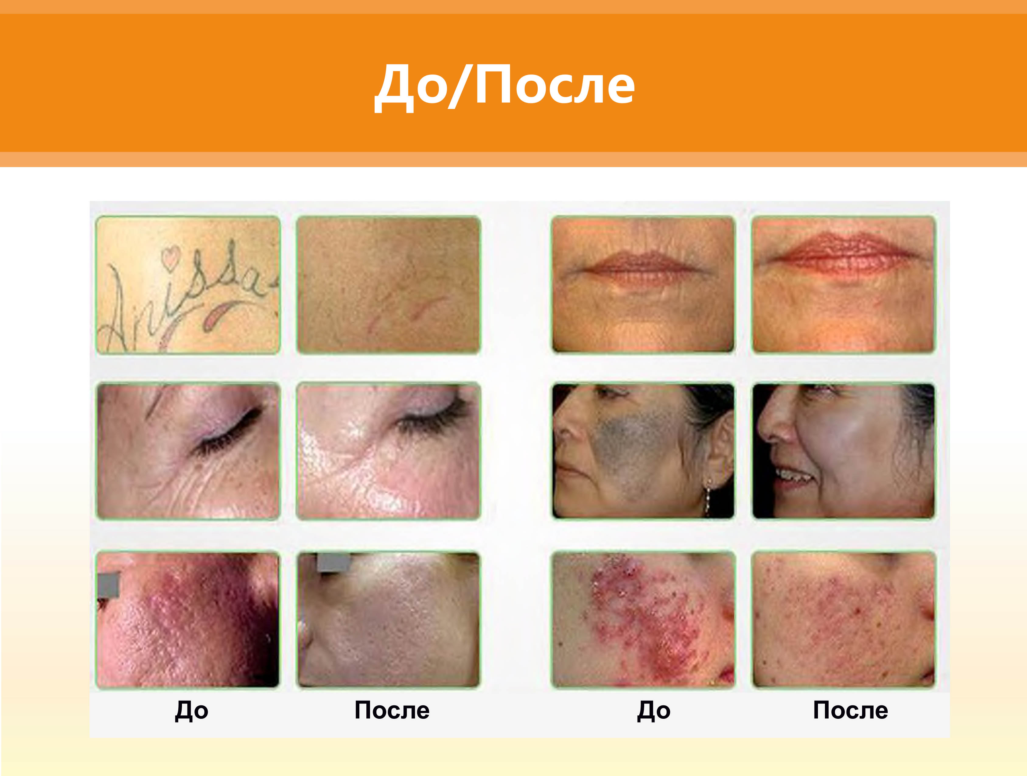 Клинические результаты